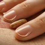 Ursachen und Behandlung: Wenn der Nagel sich vom Nagelbett löst