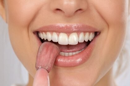 Ursachen und Behandlung von weißem Belag auf der Zunge: Was Sie wissen sollten